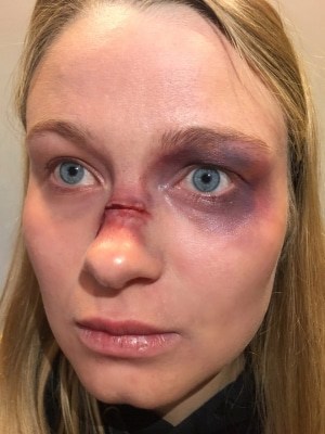 Eine plastische Wunde auf der Nase und ein blaues Auge - fertig ist das Halloween-Make-up. Foto: Heide Park Resort, 2017